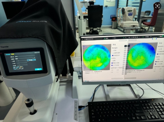 視網(wǎng)膜地形圖